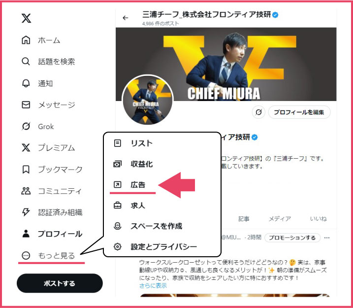 X広告